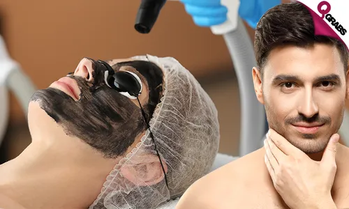 Carbon Laser for Face, Hair & Dark Areas!